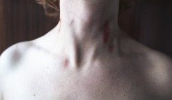 coltre:  Even the last hickey you left on my skin is gone now.