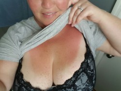 bigtitmilflover:  I might have gotten a little too much sun yesterday