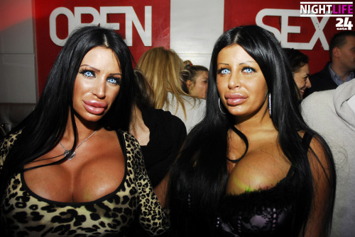 darkersideofthestone:  bleachedcandydolls:  I really do hope we see lips this size becoming more of the norm soon.  The New Average