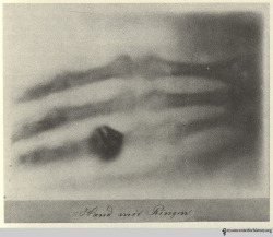 design-is-fine:  Wilhelm Röntgen, Hand mit Ringen, 1895. Photo @