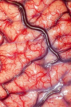 Surface of the brain