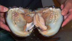 owlberta:congenitaldisease:A clam with pearls inside.this is
