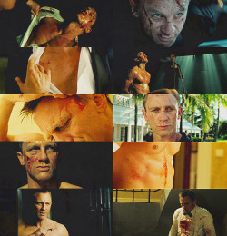 SCREENCAP MEME: bruised & battered + james bond asked by