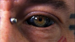 sixpenceee:  Corneal tattooing is when someone gets a tattoo