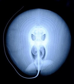 nudiemuse:  jellyfishtimes:  captainatlantic:  X-ray of a sting