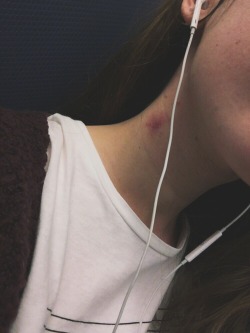 I miss hickeys