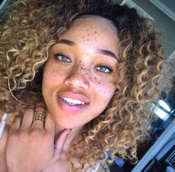 deerspace:forjeditorap:Glorious MelaninYour freckles give me