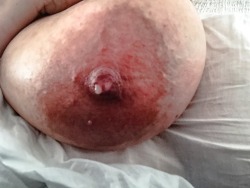 stossgebete:  Some larger and darker areolasâ€¦.. Couldnâ€™t