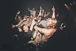 itsfuckinghardcore:  Broken Teeth Credit: Edward Mason 