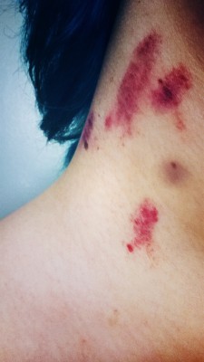 lovelycontusions: presents from my love
