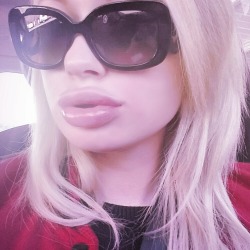 sarahmariesummer:  Got All My Injectable’s Today. I Swear I Wait Like 5 Mins in Between Treatments ;)  Why wait any longer? :)