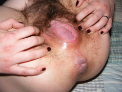 posednakedfor:  meat hole  Big prolapsing fanny