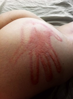 beautifullybrok:I can’t wait until His hand prints are all