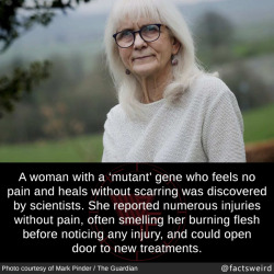 mindblowingfactz:  A woman with a ‘mutant’ gene who feels