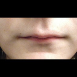 If your lips like this………..Don’t kiss