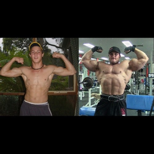 drwannabe:  Jake Nikolopoulos’s 12-year transformation (Age 15 to 27) 