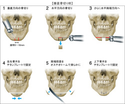 fialux:  【悲報】韓国人女子大生　整形手術により死亡