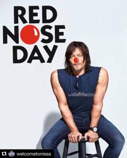 bigbaldhead:  HAPPY RED NOSE DAY 🔴  raise a lot of money for