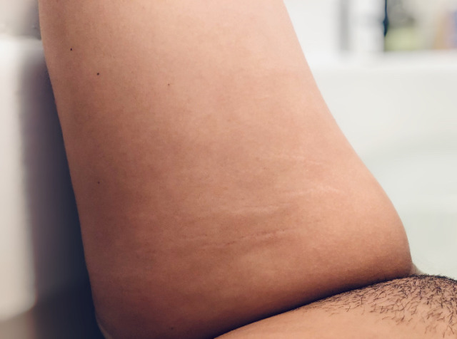 247hungry-deactivated20220924:Pubic hair and stretch marks are