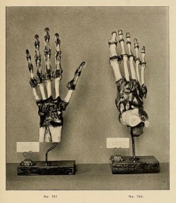 nemfrog:  Hand and foot models. Catalogue of human and comparative
