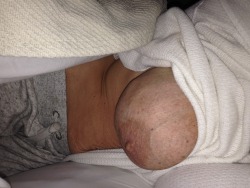 hangnmeat:Showing off my wife Katherine’s HUGE GAPING CUNT:-)