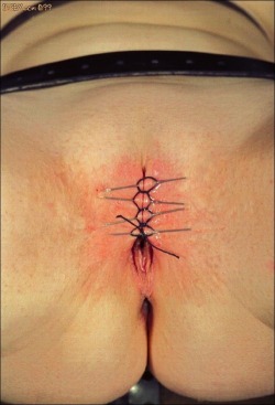 pussymodsgalore  BDSM pain games, needle play. Temporary infibulation