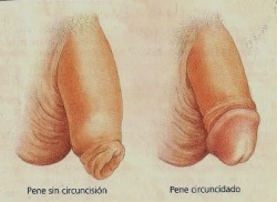 luvitcised:  circumcisedforeskin:  circumcisedperfection:  thewonderofwillows: