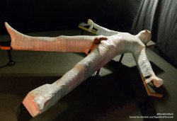 tapedandtortured:  He was in a terrible accident. We had to bandage