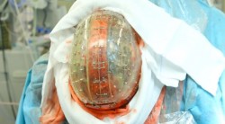 fuckyeahmedicalstuff:  The first transparent 3D-printed skull