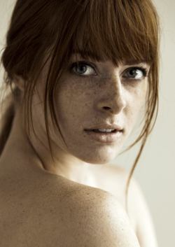 Freckles Beauty