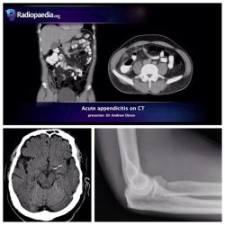 radiopaedia:10 emergency radiology video tutorials courtesy of