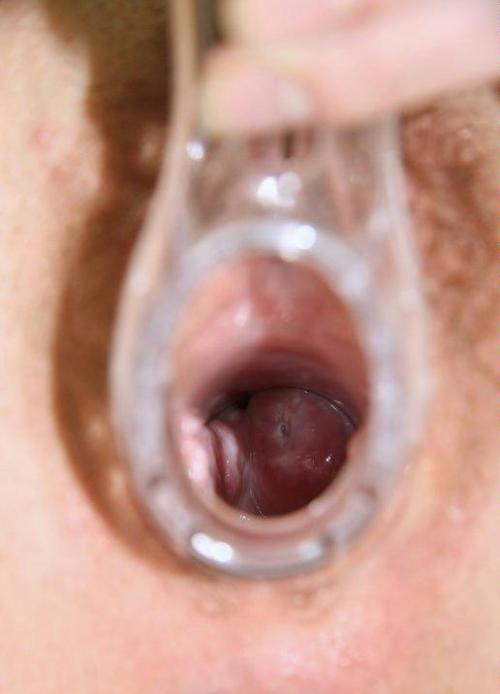 Routine use of a speculum to examine a womanâ€™s cervix often reveals a residue of semen. The use of a vaginal douche is not always enough to remove all trace of ejaculate. Poor Mary was given 12 strokes of the cane that evening because she failed a secon