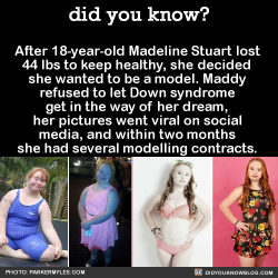 did-you-kno:  “People with Down syndrome can do anything, they