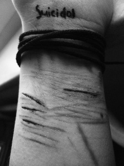The girl with a hidden scar