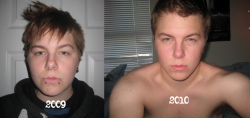 rugged-refined:  Top left: July 2009, 17 years old, pre-testosterone