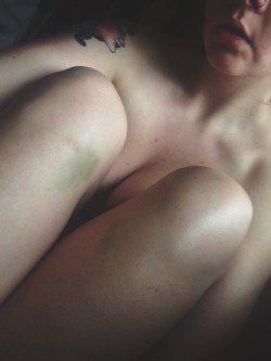 illbeg00d:  Bruise like a 🍑