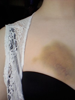rabbit-treats:  bruisesandthings:  The days following a kinky