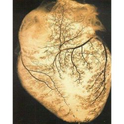 eylindc:  Human heart illuminated, blood vessels dendritic in