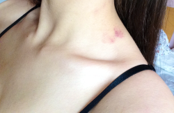 smokebluntskillcops:  Collarbones💀