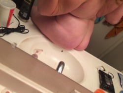 foreverforrealbabe:  Who wants to fuck my ugly fat ass &
