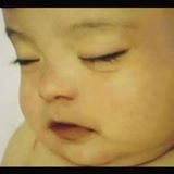 congenitaldisease:  Brianna Lopez was born on 14 February, 2002,