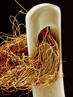 samsaranmusing:  Scanning electron microscope photos:  Needle