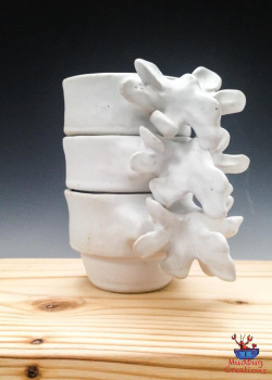 mudbugcreations:  Better pics of the lumbar spine mugs  (copyright