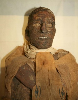 A forensic analysis carried out on the mummy of King Ramesses