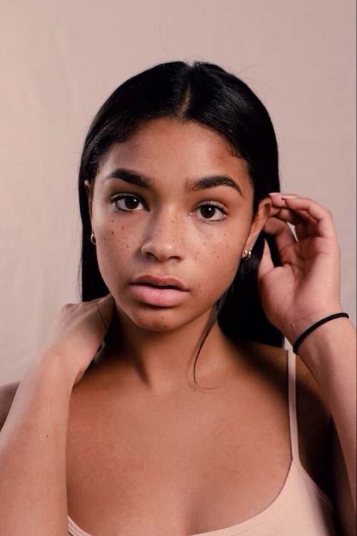 aiyanaalewis:  Freckle mami