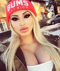 instahotsangfroid:  @pornotetonas : Winter #bimbo.💉  #BigFakeTits