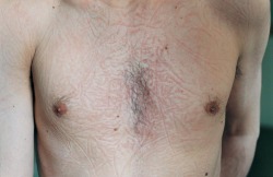 voulx:  elinor carucci : sleep marks on chest, 1997