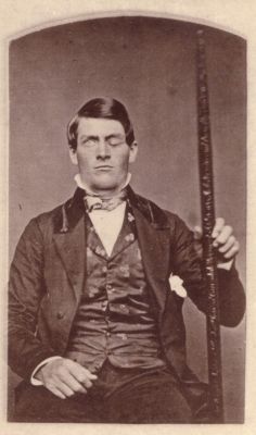 fuckyeahhistorycrushes:  This is Phineas Gage, a railroad worker