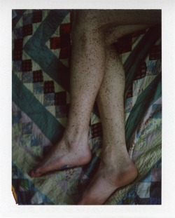 sean-clancy:  Patrick’s legs by Daniel Rampulla 