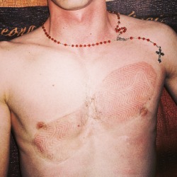overdramatics:[ID: a picture of someone’s chest, they are shirtless